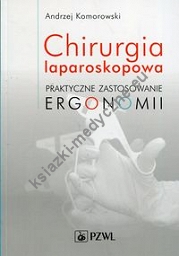 Chirurgia laparoskopowa Praktyczne zastosowanie ergonomii