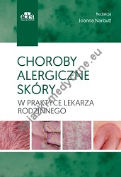 Choroby alergiczne skóry w praktyce lekarza rodzinnego