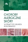 Choroby alergiczne skóry w praktyce lekarza rodzinnego