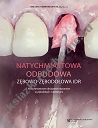 Natychmiastowa odbudowa zębowo-zębodołowa IDR