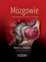  Mózgowie. Obrazowanie, patologia i anatomia. Osborn