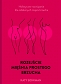 Rozejście mięśnia prostego brzucha