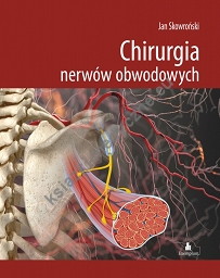 Chirurgia nerwów obwodowych 