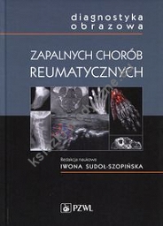 Diagnostyka obrazowa zapalnych chorób reumatycznych