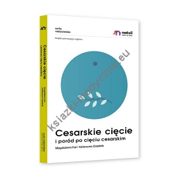 Cesarskie cięcie i poród po cięciu cesarskim