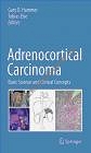 Adrenocortical Carcinoma