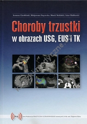 Choroby trzustki w obrazach USG, EUS i TK