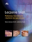 Leczenie blizn pourazowych