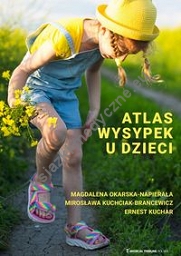 Atlas wysypek u dzieci