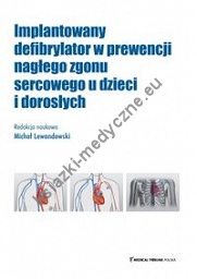 Implantowany defibrylator w prewencji nagłego zgonu sercowego u dzieci i dorosłych