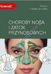 Choroby nosa i zatok przynosowych