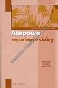 Atopowe zapalenie skóry