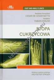 Stopa cukrzycowa