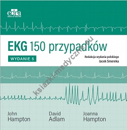 EKG 150 przypadków