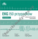 EKG 150 przypadków