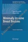 Minimally Invasive Breast Procedures