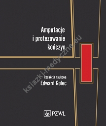 Amputacje i protezowanie kończyn