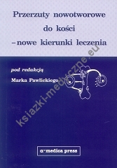 Przerzuty nowotworowe do kości – nowe kierunki leczenia