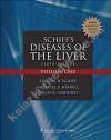 Schiff's Diseases of Liver 2 vols