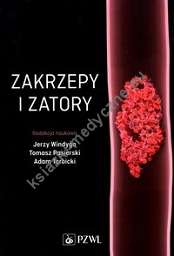 Zakrzepy i zatory