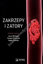 Zakrzepy i zatory