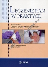 Leczenie ran w praktyce