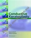 Conductive Keratoplasty