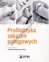 Profilaktyka zakażeń połogowych