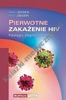 Pierwotne zakażenie HIV