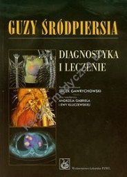 Guzy śródpiersia Diagnostyka i leczenie