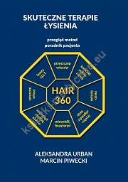 Hair 360 Skuteczne Terapie Łysienia - Przegląd Metod