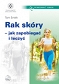 Rak skóry