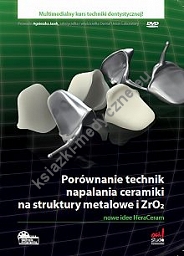 Porównanie technik napalania ceramiki na struktury metalowe i ZrO2