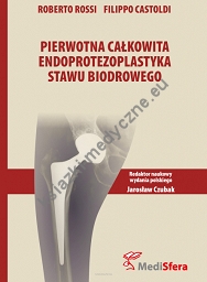 Pierwotna całkowita endoprotezoplastyka stawu biodrowego