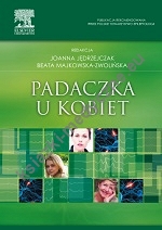 Padaczka u kobiet