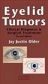 Eyelid Tumours