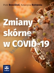 Zmiany skórne w COVID-19