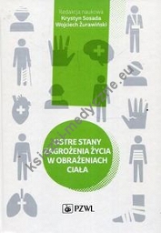 Ostre stany zagrożenia życia w obrażeniach ciała