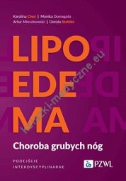Lipoedema