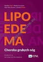 Lipoedema