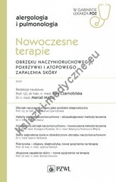 Nowoczesne terapie obrzęku naczynioruchowego, pokrzywki i atopowego zapalenia skóry.