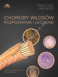 Choroby włosów. Rozpoznanie i leczenie