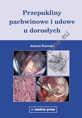 Przepukliny pachwinowe i udowe u dorosłych