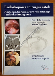 Endoskopowa chirurgia zatok. Anatomia, trójwymiarowa rekonstrukcja i technika chirurgiczna