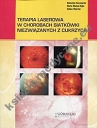 Terapia laserowa w chorobach siatkówki niezwiązanych z cukrzycą