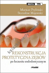 Rekonstrukcja protetyczna zębów po leczeniu endodontycznym