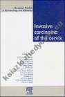 Invasive Carcinoma Of The Cervix: EBCOG Series