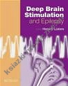 Deep Brain Stimulation & Epilepsy