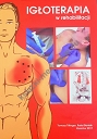 Igłoterapia w rehabilitacji