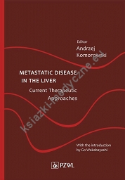 Metastatic Disease in the Liver - Current Therapeutic Approaches